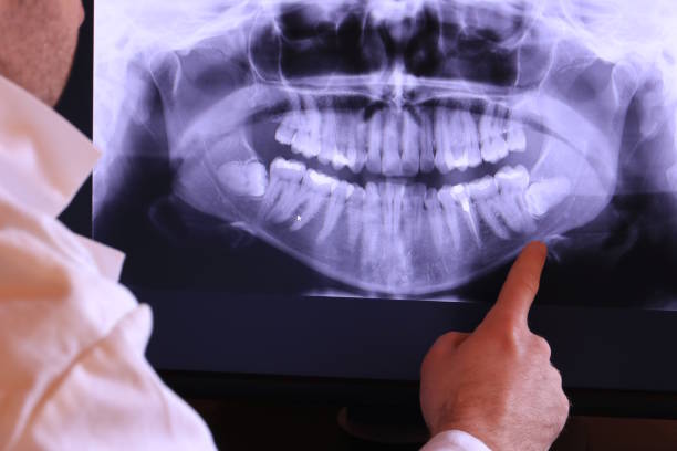 Best Emergency Tooth Extraction in Glen Ellyn, IL